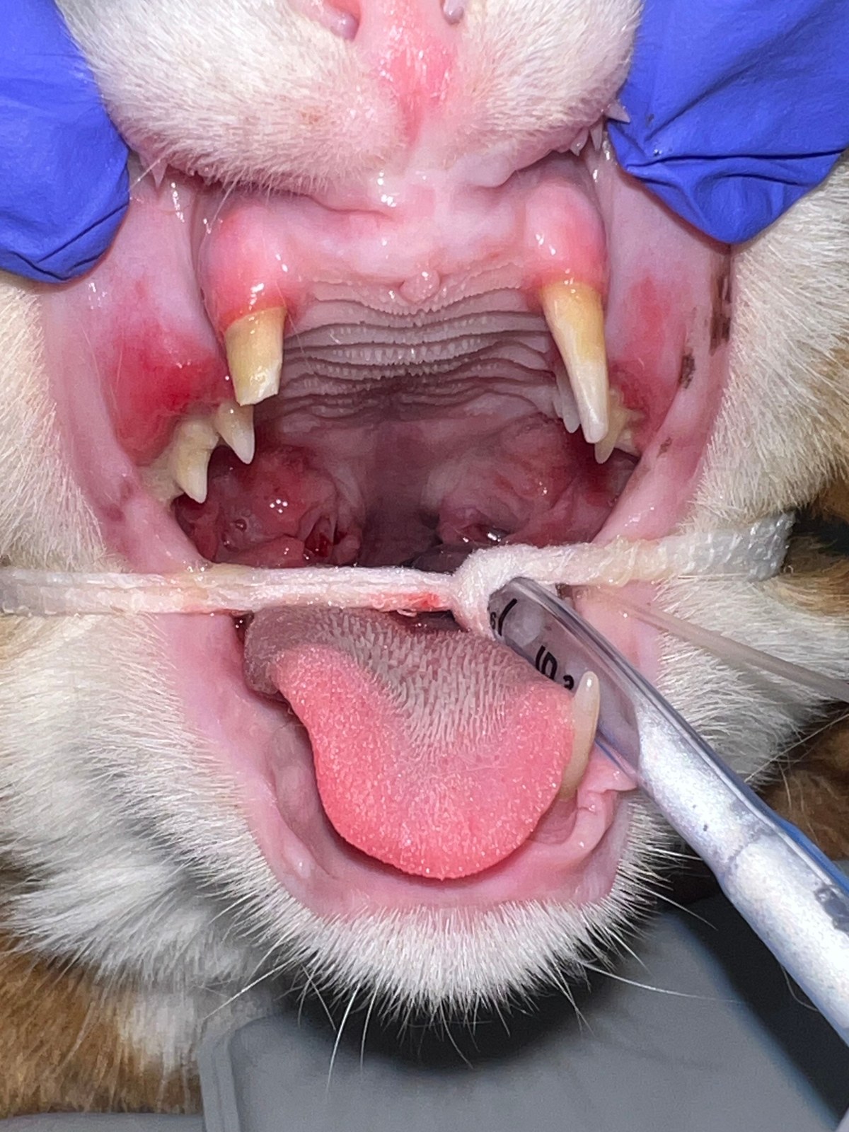 Archie's full mouth makeover
